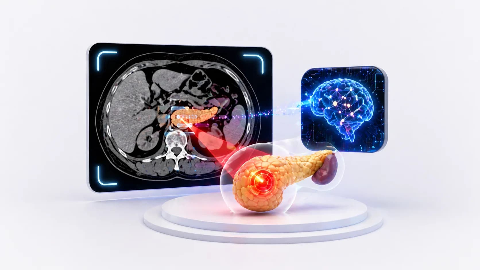 REDMOD AI, 임상 진단 평균 475일 전 췌장암 검출, 방사선 전문의 대비 민감도 73% vs 39%